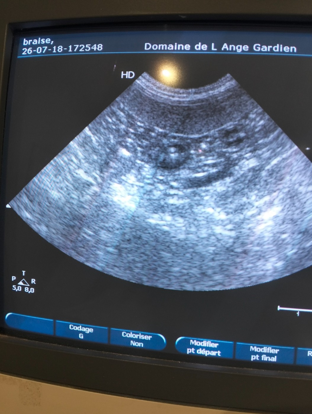 Confirmation de gestation